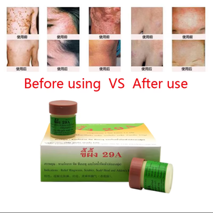 Fórmula Tradicional, para Problemas como Tinea, Eczema, Dermatitis, Acné, etc. - Product Image 4