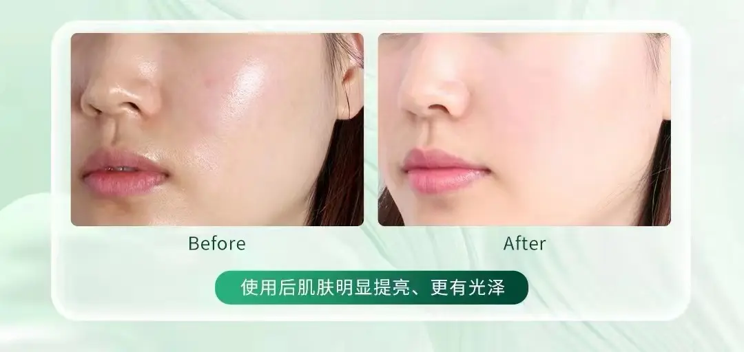 Bán buôn tùy chỉnh nhân bản Loại III Collagen mặt cơ thể Mặt Nạ Khô da nhờn sửa chữa vá băng bông tấm mặt nạ mẫu