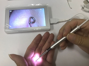 Herramienta de eliminación de cera de oído inteligente con luz LED, cámara recargable USB, auricular para IOS, Android Phone View - Product Image 2