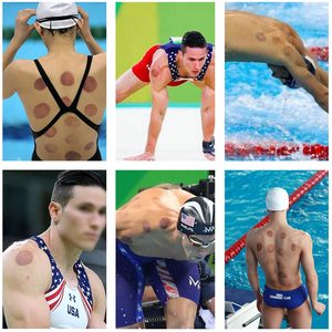 Ventouses de thérapie par ventouses de haute qualité <span class=keywords><strong>en</strong></span> gros, ventouses de thérapie par ventouses pour les articulations - Product Image 6