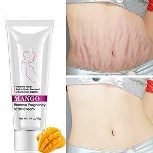 Private Label Mango smagliature cicatrice cicatrice guarigione <span class=keywords><strong>crema</strong></span> <span class=keywords><strong>per</strong></span> rimozione unguento <span class=keywords><strong>per</strong></span> la vecchia cicatrice - Product Image 2