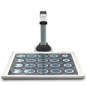 A3 CT <span class=keywords><strong>scanner</strong></span> <span class=keywords><strong>de</strong></span> film 15MP visualiseur portable USB <span class=keywords><strong>scanner</strong></span> <span class=keywords><strong>de</strong></span> caméra <span class=keywords><strong>de</strong></span> <span class=keywords><strong>documents</strong></span> pour l'hôpital - Product Image 4