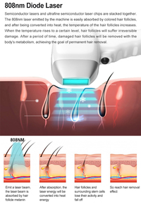 Dispositivo de Belleza 3 en 1 de 808nm: Solución Profesional para el Cuidado de la Piel, Depilación y Problemas de Pigmentación - Product Image 6