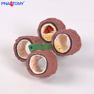 Modelo Anatómico Vascular de Cuatro Etapas para el Estudio de la <span class=keywords><strong>Enfermedad</strong></span> de <span class=keywords><strong>Arteriosclerosis</strong></span> Humana, Modelo de Vaso Arterial Humano, Regalo Educativo - Product Image 3