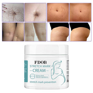 Creme Poderoso para Estrias, Repara Rapidamente Estrias de Gravidez, Estrias Pós-parto e Estrias de Obesidade - Product Image 2