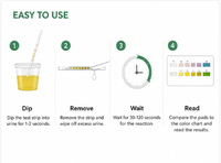 Bandelettes de test urinaire URS-10T, 10 paramètres, kit d'analyse d'urine, bandelettes de test urinaire médical
