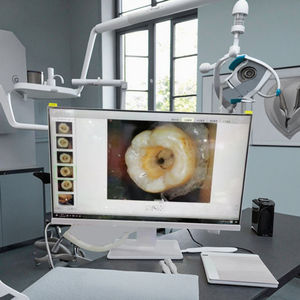 Endoscopio dentale elettrico All-in-One con chiara impugnatura dello schermo di Imaging in tempo reale per una diagnosi efficiente - Product Image 6