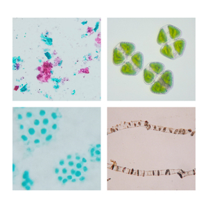 Lames de microscope cellulaire d'algues FRT3002 <span class=keywords><strong>Lichen</strong></span> Thallus Anabaena Biologie Enseignement Recherche Algues 10 articles Lames Botanique Verre - Product Image 6