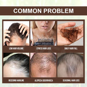 Otvena เซรั่มป้องกันผมร่วงสมุนไพรน้ำมันปลูกผมร่วงและศีรษะล้านจากขิงร่วง - Product Image 3