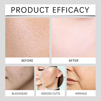 PINNSKIN Sérum Microneedling en Ampoule Vitamine C Thé Vert Aloès Vera Liquide 5ml pour une Peau Hydratée et Éclatante Micro-Infusion