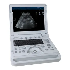 CONTEC CMS1700B Continous Doppler Ultrasound Equipment Ultrasonography Color Doppler Usg