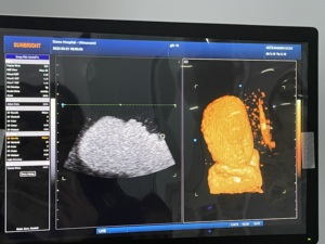 Carro más vendido <span class=keywords><strong>Doppler</strong></span> OB Embarazo 3D/4d Ultrasonido <span class=keywords><strong>Doppler</strong></span> color - Product Image 6