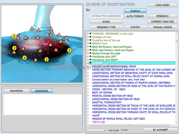 Hot selling 12d aura nls health analyzer with factory price