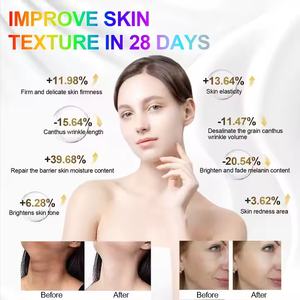 Phenitech, красная и синяя и желтая маска для подтяжки лица, Латинская американская силиконовая маска для шеи, спектрометр с косметической маской для шеи - Product Image 5