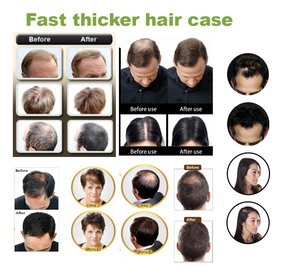 Spray de Fibra Capilar para el Crecimiento del Cabello, 100% Natural a Base de Hierbas, Alta Calidad, 60ML*3 Botellas, Eternal <span class=keywords><strong>Elinor</strong></span>, ¡Oferta! - Product Image 3