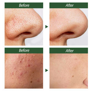 <span class=keywords><strong>โฟม</strong></span><span class=keywords><strong>ล้าง</strong></span><span class=keywords><strong>หน้า</strong></span>สูตรอ่อนโยนสำหรับผิว<span class=keywords><strong>แพ้</strong></span><span class=keywords><strong>ง่าย</strong></span> <span class=keywords><strong>ลด</strong></span>รอยแดง บำรุงผิวชุ่มชื้นทุกวัน ด้วยสารสกัดจากสนและซิก้า ผสมโปรไบโอติก 1% - Product Image 5