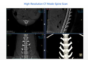 Équipement vétérinaire, tomodensitométrie, imagerie par tomodensitométrie pour chien et chat, <span class=keywords><strong>scanner</strong></span> CT pour animaux de compagnie, <span class=keywords><strong>scanner</strong></span> CT pour animaux de compagnie, gantry C-arm, numérisation rapide en 10 secondes, hybride - Product Image 4