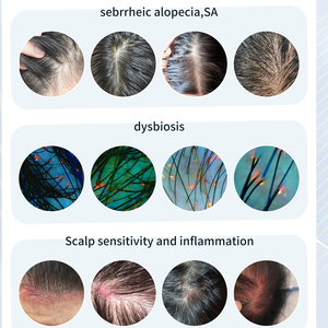 Ai Techniek Hele Gezichts Scanning Multi-Spectrum Huid En Haar Hoofdhuid Analyzer Machine Met Meerdere Talen - Product Image 6