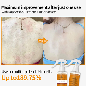 Spray Exfoliante Blanqueador OEM con Cúrcuma y Ácido Kójico, Limpieza Profunda, Suavizante e Hidratante para Cuerpo y Rostro - Product Image 3