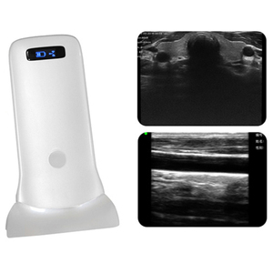 Ecógrafo Doppler Lineal Inalámbrico <span class=keywords><strong>de</strong></span> Palma CProbe-5W <span class=keywords><strong>de</strong></span> Rango Ultraamplio para Examen <span class=keywords><strong>de</strong></span> Senos, <span class=keywords><strong>Cadera</strong></span> y Músculos Abdominales - Product Image 5