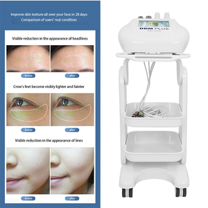 Carrito con Instrumento de 7mhz de Material ABS para Lifting Facial, Reafirmación de la Piel, Limpieza y Eliminación de Puntos Negros para Rostro y Cuerpo - Product Image 1