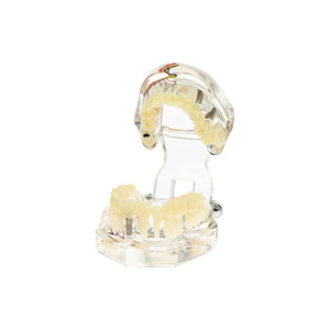 Modelo patológico hemisférico transparente, modelo dental patológico completo, modelo dental desmontable, implante - Product Image 2