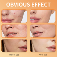 Sérum Visage Éclaircissant à la Vitamine C en Gros – Élimine les Taches Brunes, Sérum Blanchissant pour le Soin de la Peau du Visage 30ml