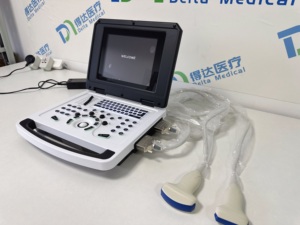 Escáner de Ultrasonido Blanco y Negro de Alta Calidad para Hospital, Sistema de Diagnóstico Veterinario, Máquina de Ultrasonido Portátil para Humanos - Product Image 5