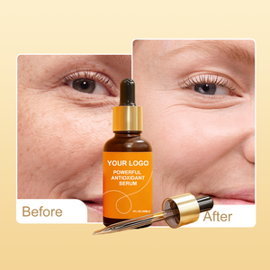 Suero Antioxidante Potente Personalizado con <span class=keywords><strong>Vitamina</strong></span> <span class=keywords><strong>C</strong></span> Antienvejecimiento, Ilumina la Piel Opaca y Reduce las Manchas Oscuras - Product Image 2