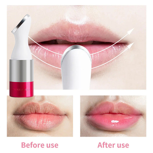 Dispositivo Eléctrico <span class=keywords><strong>de</strong></span> <span class=keywords><strong>Aumento</strong></span> <span class=keywords><strong>de</strong></span> <span class=keywords><strong>Labios</strong></span> GREENLEM. - Product Image 4