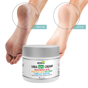En stock 40% Urea Foot Cream -281241 Suavizante e Hidratante Cuidado de manos <span class=keywords><strong>y</strong></span> pies Peel Crack Cream Foot Skin Care - Product Image 1