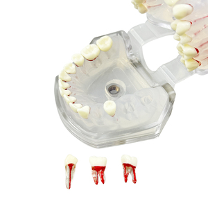 Modelo Dental de Alta Calidad, Modelo de Práctica de Enseñanza de Raíces Dentales, Desmontable, para Demostración de Dentistas, Entrenamiento de Estudiantes, Laboratorio - Product Image 5
