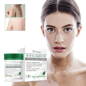 EELHOE Vitiligo-Creme Behandlung Aufhellungs-Nartpflege Entfernung Behandlung von Vitiligo Pigmentierungscreme