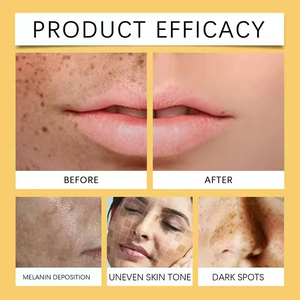 Private Label Organic Vegan <strong>Vitamin</strong> <strong>C</strong> &amp; Turmeric Face <strong>Serum</strong> Oil Skin Brightening &amp; Whitening For Dark Spots Facial Care - Product Image 2
