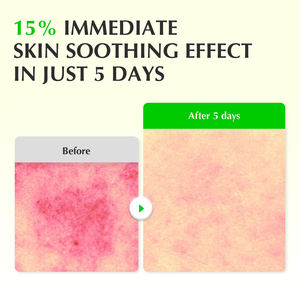 Serum Kapsul Wajah Label Pribadi dengan Lidah Buaya dan PDRN Artemisia Perawatan Kulit untuk Wajah yang Meradang & Menenangkan - Product Image 3