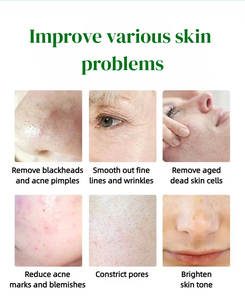 Peeling aux algues vertes 2026, peeling aux algues marines dans SKIN <span class=keywords><strong>MediSpa</strong></span> Medical Spa - Product Image 4
