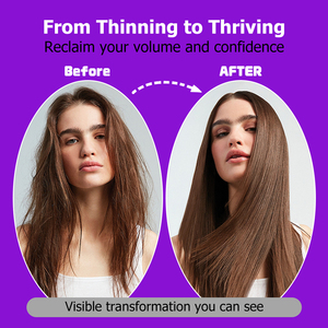 Gummies OEM en gros pour la croissance des cheveux : Soutien de la structure du collagène, production de kératine, nutrition des follicules capillaires - Product Image 5