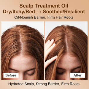 Natural Private Label Organic Plant Oils Soothing <strong>Factors</strong> Deep Nourishment Soothing Repair Hair Scalp <strong>Care</strong> Growth Oil - Product Image 2