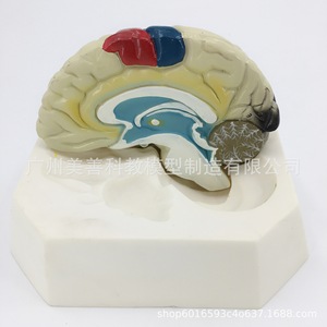 Modèle de lobulation cérébrale, modèle d'artère cérébrale, modèle d'anatomie du cerveau, modèle de région fonctionnelle du cerveau, modèle de cerveau en couleur - Product Image 5