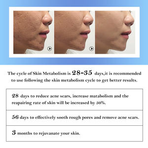 بسعر الجملة بشعار مصمم حسب الطلب خلوية خلوية نباتية للعناية بالبشرة Egf سيروم علاج حب الشباب OEM علامة خاصة - Product Image 4