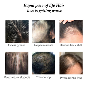 Private Label Natural Rosmarin Nou rishing Scalp Haarpflege Haarausfall Behandlung Haar wachstums serum