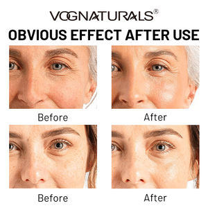 OEM OBM Gel d'aloe vera à la chlorophylle naturelle et biologique, crème détoxifiante, masque facial, nettoyage en profondeur, resserre les pores, contrôle du sébum pour une peau matifiée - Product Image 5