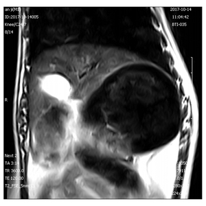 Thiết Bị <span class=keywords><strong>MRI</strong></span> Y Tế Vet Máy Quét Hình Ảnh Cộng Hưởng Từ Trường Bệnh Viện Động Vật Máy Quét <span class=keywords><strong>MRI</strong></span> Thú Y Prince 0.35T - Product Image 4