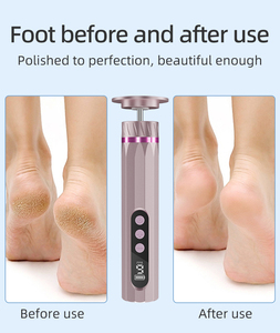 Lime à pieds <span class=keywords><strong>électrique</strong></span> sans fil 2-en-1 avec écran LCD pour éliminer les callosités, les peaux mortes, les ongles épais, les talons et les semelles - Product Image 5