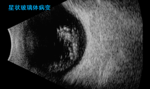 Escáner Oftálmico SK-3000A, Equipo de Oftalmología con Escaneo AB, Instrumento de Ultrasonido <span class=keywords><strong>Ocular</strong></span> - Product Image 4