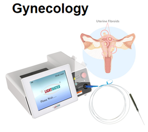 Máquina Láser de 980nm y 1470nm para Rejuvenecimiento Ginecológico y Tensado Vaginal - Product Image 4