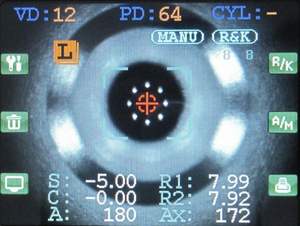 KR-9000 RM-9000เครื่องตรวจวัดสายตาแบบออโต้เครื่องทำดัชนีหักเหของแสงเครื่องมือออปติคอลเครื่องตรวจวัด V017อัตโนมัติ - Product Image 5