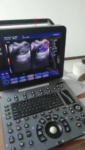 Longermay thú y xách tay đầy đủ kỹ thuật số siêu âm chẩn đoán Scanner - Product Image 3