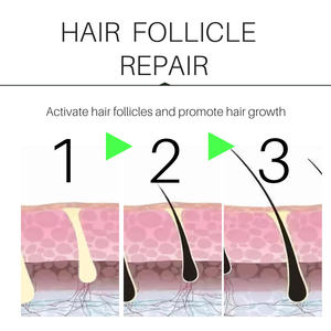 Natural Nourish Follicle Anti-<b>Hair</b> Loss Silicone-Free <b>Hair</b> <b>Growth</b> <b>Spray</b> 30ml Suitable for Thinning <b>Hair</b> - Product Image 3