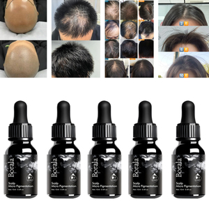 Kit <span class=keywords><strong>de</strong></span> Microblading OEM para Academia, Dermógrafo para Micropigmentación Capilar con Pigmento SMP - Product Image 1